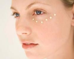 silc-lasik-center-punya-alat-penyembuh-refraksi-mata-yang-dipakai-pilot-tempur-as