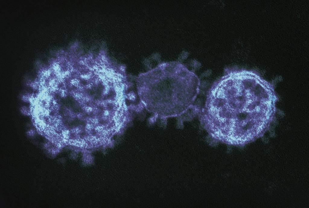 Gambar Coronavirus, diambil dari AAO content last reviewed 05/20